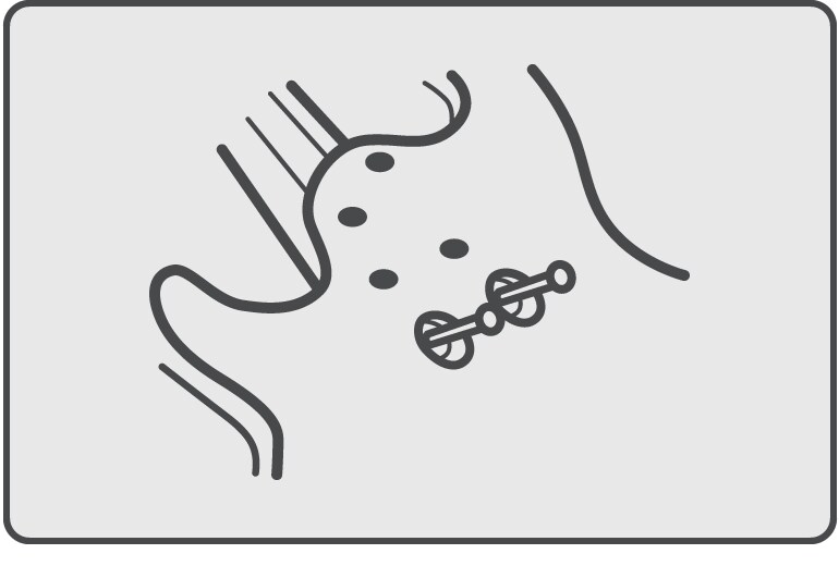 Miter Bolting (boulonnage en onglet)